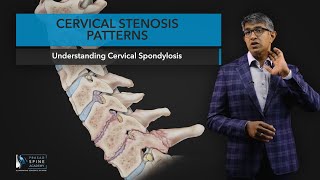 Cervical Stenosis Patterns [upl. by Mirelle24]