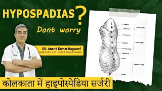 Best HYPOSPADIAS Surgery in Kolkata  Best Age for Hypospadias Surgery  Myths and Facts [upl. by Einreb196]