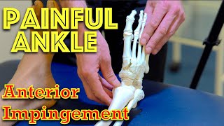 Ankle Pain  Anterior Impingement  Dr Gill [upl. by Gottwald]