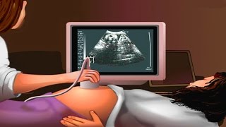 How Ultrasound Works Animation  Ultrasound Scan During Pregnancy Video  USG Medical Imaging [upl. by Inavihs144]