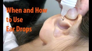 Antibiotic Ear Drops  When and How to Use Ear Drops Properly [upl. by Hardi]