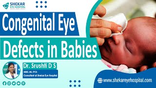 Congenital Eye Disease  Best Pediatric Eye Hospital in Bangalore  Shekar Eye Hospital [upl. by Rainger]