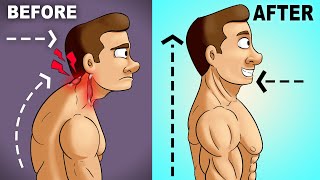 Fix Forward Head Posture FAST 5 Easy Steps [upl. by Eilrahc304]