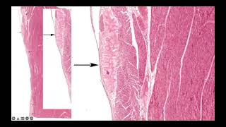 REPASO CARDIOVASCULAR Dra Margarita De Lima Eljuri [upl. by Novad775]