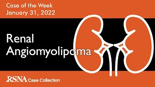 Case of the Week Renal Angiomyolipoma [upl. by Laeynad200]