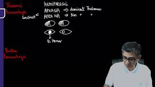 Clinical features of Intracerebral Hemorrhage Revision for FMGE NEET PG by Dr Deepak Marwah [upl. by Siron145]