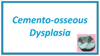 Cementoosseous Dysplasia  Important Notes  Diseases of Bone and Joint 4  Oral Pathology [upl. by Aes]