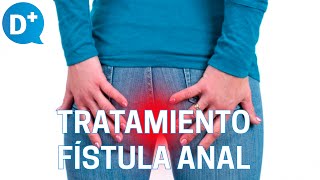 Diagnóstico y tratamiento de la fístula anal [upl. by Lorinda]