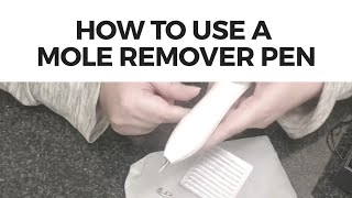 How to Use the Mole Remover Pen  Tutorial and Demo [upl. by Heinrick]