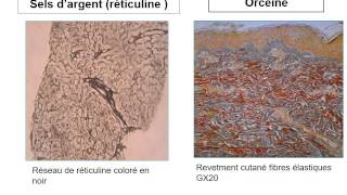 ANATOMIE PATHOLOGIQUE Travaux Pratiques [upl. by Rehpotsirc]