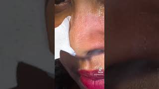 Nose strip removal biore Cleaning my pores [upl. by Llemart]