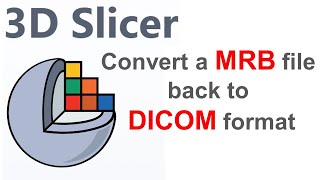 3D Slicer save a MRB file in three types of DICOM format of magnetic resonance imaging scans  MRI [upl. by Tillfourd]