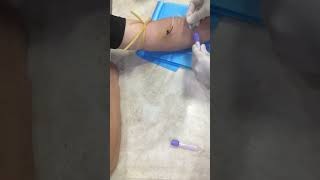 Butteefly needle bloodtest butterfly hospital butterflyneedle doctor [upl. by Navada]