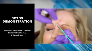 Botox® Demonstration Corrugators Forehead amp Crowsfeet  Ramsey Choucair MD  Ph 2143899797 [upl. by Tjaden]