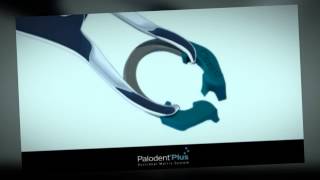 Palodent Plus for Class II [upl. by Karolyn]