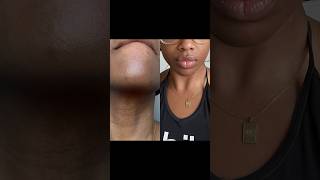 Topicals Faded Serum Before and After skincare hyperpigmentation blemishes topicalsfaded [upl. by Kosiur]