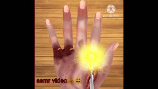 ASMR video finger treatment 😆😆 [upl. by Alet]