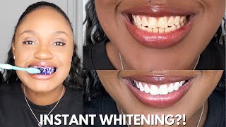 I INSTANTLY WHITENED MY TEETH IN 30 SECONDS USING HISMILE Shocking Results [upl. by Anahsor]