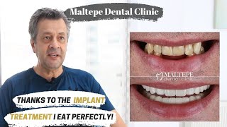 Dental Implant Treatment in Istanbul Turkey [upl. by Morvin343]