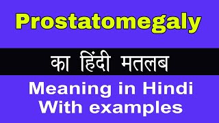 Prostatomegaly Meaning in HindiProstatomegaly का अर्थ या मतलब क्या होता है [upl. by Aillimac]