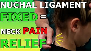 Nuchal Ligament FIXED  Neck Pain RELIEF [upl. by Darill]