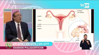 Cuerpo Médico Ovarios poliquístico 06092023  TVPerú [upl. by Sucy556]