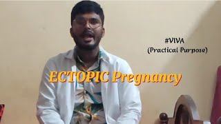 Obsampgyn viva Ectopicpregnancy Part 1 Introduction Site amp pathogenesis [upl. by Adhern]