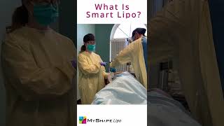 What is smart lipo [upl. by Rivkah687]