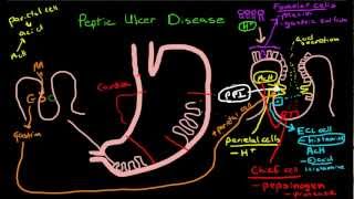 Peptic Ulcer Disease Pathophysiology [upl. by Citron]