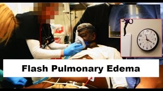 Flash Pulmonary Edema Emergency [upl. by Nevaj830]