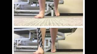 Kinesiology Rocktape to correct over pronation [upl. by Crean]