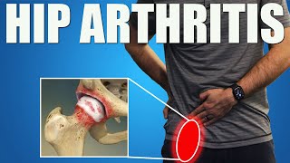 HIP OSTEOARTHRITIS BEST Exercises Stretches amp Advice for Hip amp Groin Pain Relief [upl. by Culosio]