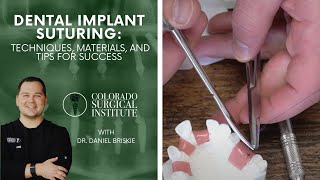 Dental Implant Suturing Techniques Materials and Tips for Success [upl. by Eninnaj]