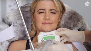 My Coolsculpting Fat Freeze Experience  Is it worth the money [upl. by Anner]