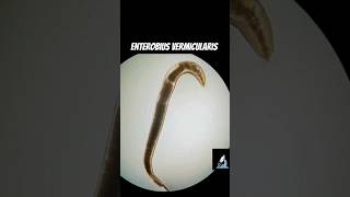 Enterobius vermicularis  Pinworm and its eggs [upl. by Merp37]