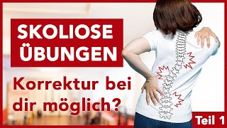 Effektive Skoliose Übungen für dein Training  Gegen Beschwerden  Fit amp Schmerzfrei [upl. by Francis]