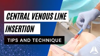 Central Venous Catheter CVC Demonstration  anesthesiology anesthesia anaesthesia cvc [upl. by Nastassia812]