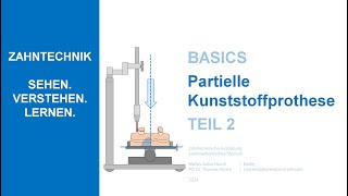 Partielle Kunststoffprothese  Teil 2 [upl. by Alarick288]