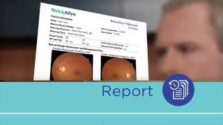 Welch Allyn RetinaVue Network Product Demonstration Video  Short [upl. by Esyahc]