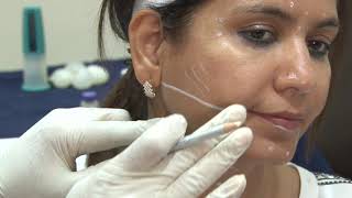 Complete video training on Botulinum Injections for face and Neck [upl. by Eicyal]