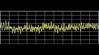 Scar Tissue  Rife Frequencies [upl. by Enahs]