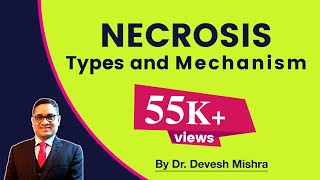 Necrosis  Types and Mechanism General Pathology [upl. by Terencio]