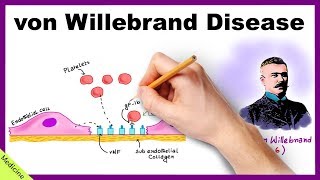 VON WILLEBRAND DISEASE Pathophysiology Clinical Findings Diagnosis Treatment [upl. by Niles517]