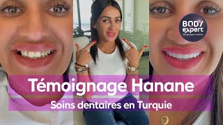 SOINS DENTAIRES EN TURQUIE  🦷 Témoignage de Hanane  22 couronnes Emax  BODYEXPERT [upl. by Adamec595]