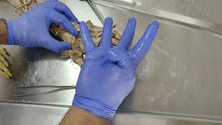 Dissection  Revision of Lumbricals of the hand [upl. by Hanid786]