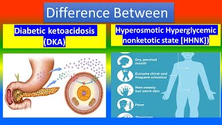 Diabetic ketoacidosis DKA Vs Hyperosmotic Hyperglycemic nonketotic state  HHNK [upl. by Acinej375]