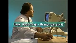 How to do abdominal ultrasound examination [upl. by Ahsemaj16]