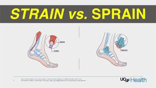 Strain vs Sprain Treatment [upl. by Ellora622]