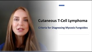 Criteria to Diagnose Mycosis Fungoides Chapter 1 [upl. by Keavy]