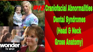 Craniofacial amp Dental Syndromes INBDE Dental Boards [upl. by Magocsi]